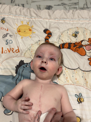 Kohen, Children's Colorado Congenital Heart Disease Patient