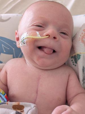 Alexander at two months post-op